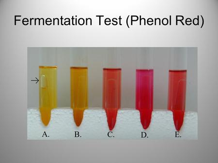 Fermentation Test (Phenol Red). John Snow’s Cholera Spot Map.