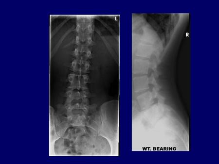 Postoperative infections Diagnostic & therapeutic principles are same Management as per case merit.