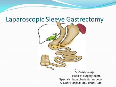 Laparoscopic Sleeve Gastrectomy