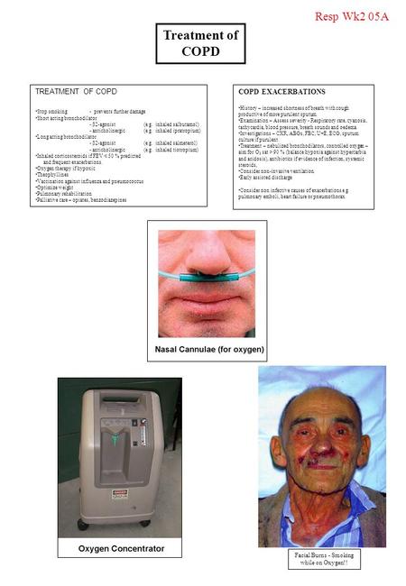 Facial Burns - Smoking while on Oxygen!!