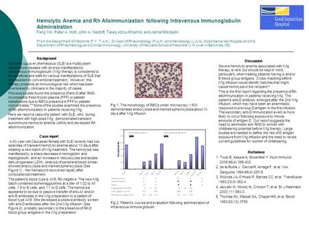 Hemolytic Anemia and Rh Alloimmunization following Intravenous Immunoglobulin Administration Fang Yin, Peter A. Holt, John A. Nesbitt, Tareq Abou-Khamis,