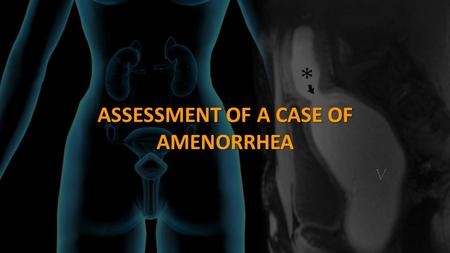 ASSESSMENT OF A CASE OF AMENORRHEA