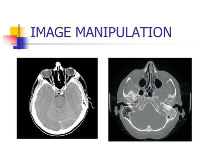 IMAGE MANIPULATION. THOSE TECHNIQUES OR PROCESSES WHICH MODIFY AN IMAGE OR GROUP OF IMAGES TO ENHANCE THE VISIBILITY OF USEFUL INFORMATION WHILE SUPPRESSING.