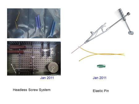 Jan 2011 Headless Screw System Elastic Pin Jan 2011.