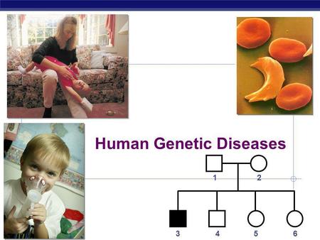 Human Genetic Diseases