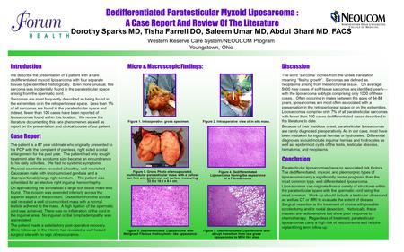 Dedifferentiated Paratesticular Myxoid Liposarcoma :