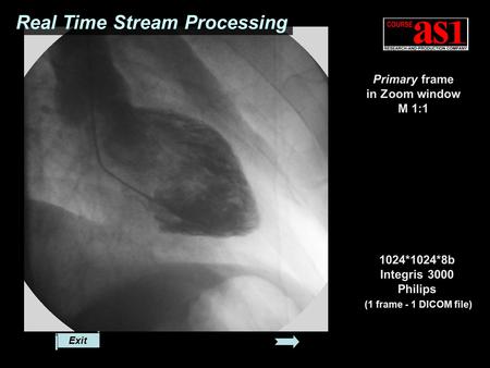 Real Time Stream Processing