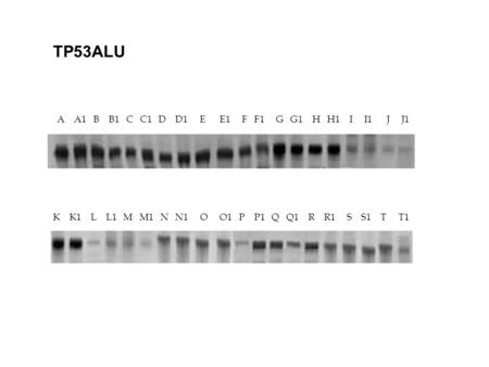 A A1 B B1 C C1 D D1 E E1 F F1 G G1 H H1 I I1 J J1 K K1 L L1 M M1 N N1 O O1 P P1 Q Q1 R R1 S S1 T T1 TP53ALU.