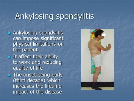 Ankylosing spondylitis