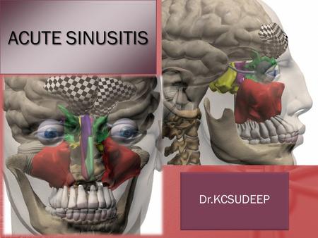 ACUTE SINUSITIS Dr.KCSUDEEP.