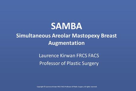 Copyright  Laurence Kirwan FRCS FACS Professor of Plastic Surgery. All rights reserved. SAMBA Simultaneous Areolar Mastopexy Breast Augmentation Laurence.