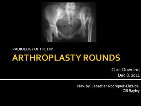 RADIOLOGY OF THE HIP Chris Dowding Dec 8, 2011 Prev. by: Sebastian Rodriguez-Elizalde, Gill Bayley.