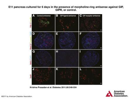 E11 pancreas cultured for 6 days in the presence of morpholine-ring antisense against GIP, GIPR, or control. E11 pancreas cultured for 6 days in the presence.