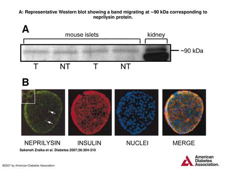 A: Representative Western blot showing a band migrating at ∼90 kDa corresponding to neprilysin protein. A: Representative Western blot showing a band migrating.