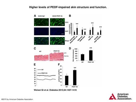 Higher levels of PEDF-impaired skin structure and function.