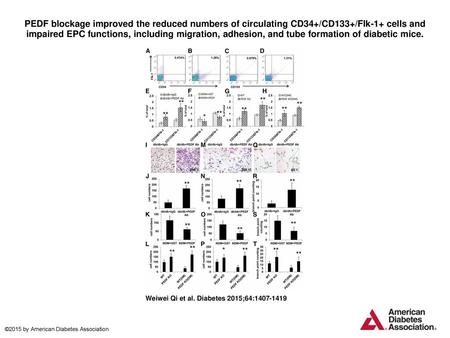 PEDF blockage improved the reduced numbers of circulating CD34+/CD133+/Flk-1+ cells and impaired EPC functions, including migration, adhesion, and tube.