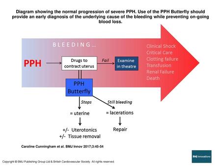 Diagram showing the normal progression of severe PPH