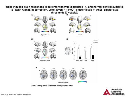 Odor-induced brain responses in patients with type 2 diabetes (A) and normal control subjects (B) (with AlphaSim correction, voxel level: P < 0.001, cluster.