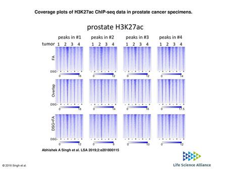 Coverage plots of H3K27ac ChIP-seq data in prostate cancer specimens.