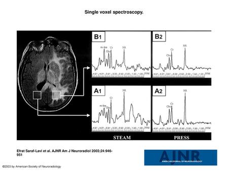 Single voxel spectroscopy.