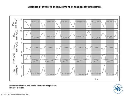 Example of invasive measurement of respiratory pressures.