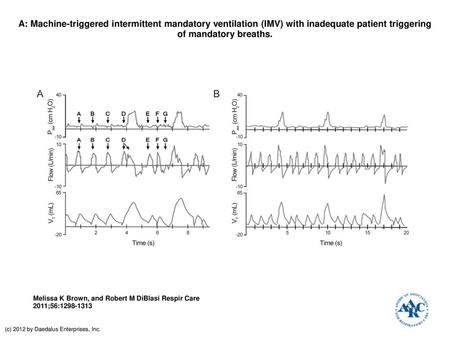 A: Machine-triggered intermittent mandatory ventilation (IMV) with inadequate patient triggering of mandatory breaths. A: Machine-triggered intermittent.