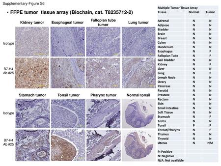 ・FFPE tumor tissue array (Biochain, cat. T )