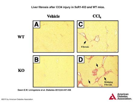 Liver fibrosis after CCl4 injury in 5αR1-KO and WT mice.