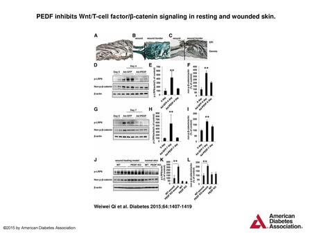 PEDF inhibits Wnt/T-cell factor/β-catenin signaling in resting and wounded skin. PEDF inhibits Wnt/T-cell factor/β-catenin signaling in resting and wounded.