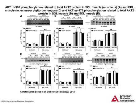 AKT thr308 phosphorylation related to total AKT2 protein in SOL muscle (m. soleus) (A) and EDL muscle (m. extensor digitorum longus) (D) and AKT ser472.