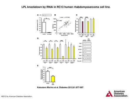 LPL knockdown by RNAi in RC13 human rhabdomyosarcoma cell line.