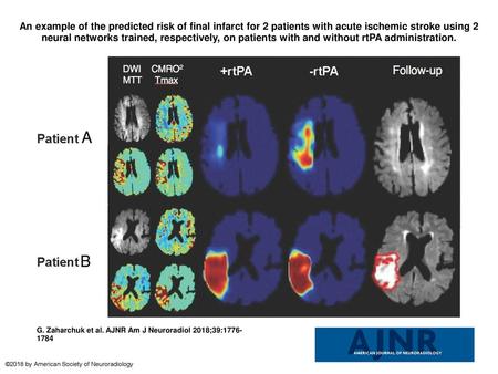 An example of the predicted risk of final infarct for 2 patients with acute ischemic stroke using 2 neural networks trained, respectively, on patients.