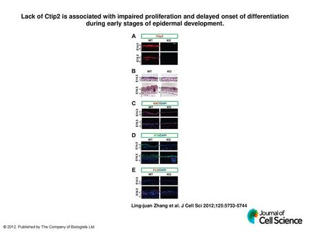 Lack of Ctip2 is associated with impaired proliferation and delayed onset of differentiation during early stages of epidermal development. Lack of Ctip2.