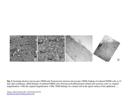 Fig. 2. Scanning electron microscopic (SEM) and Transmission electron microscopic (TEM) findings of cultured NHNE cells at 14 days after confluence. SEM.