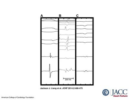 Jackson J. Liang et al. JCHF 2014;2: