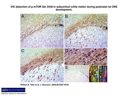 IHC detection of p-mTOR Ser 2448 in subcortical white matter during postnatal rat CNS development. IHC detection of p-mTOR Ser 2448 in subcortical white.