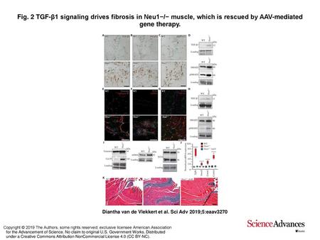 Fig. 2 TGF-β1 signaling drives fibrosis in Neu1−/− muscle, which is rescued by AAV-mediated gene therapy. TGF-β1 signaling drives fibrosis in Neu1−/− muscle,