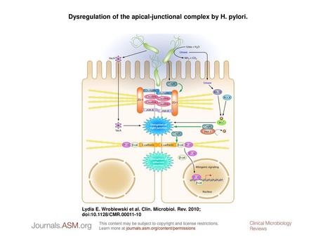 Dysregulation of the apical-junctional complex by H. pylori.