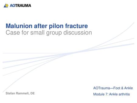 Malunion after pilon fracture