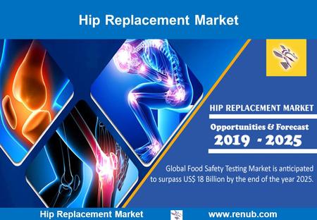 Hip Replacement Market   Hip Replacement Market.