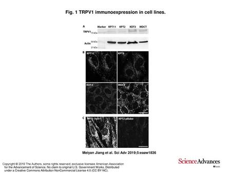 Fig. 1 TRPV1 immunoexpression in cell lines.