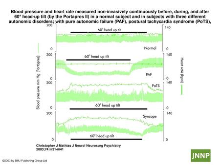 Blood pressure and heart rate measured non-invasively continuously before, during, and after 60° head-up tilt (by the Portapres II) in a normal subject.