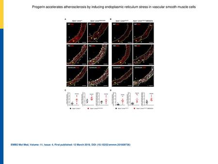 Progerin accelerates atherosclerosis by inducing endoplasmic reticulum stress in vascular smooth muscle cells A, BRepresentative immunofluorescence images.