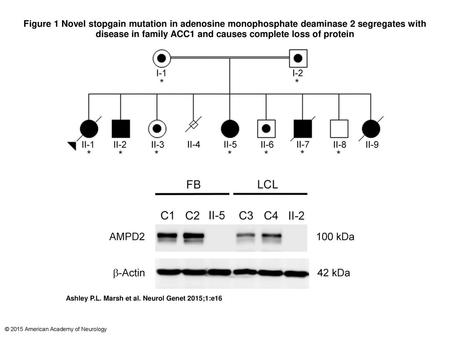 Figure 1 Novel stopgain mutation in adenosine monophosphate deaminase 2 segregates with disease in family ACC1 and causes complete loss of protein Novel.