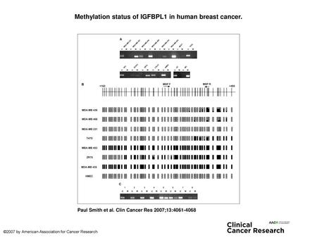 Methylation status of IGFBPL1 in human breast cancer.