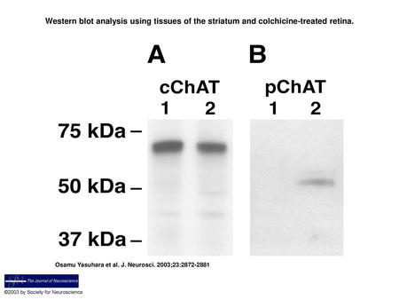 Western blot analysis using tissues of the striatum and colchicine-treated retina. Western blot analysis using tissues of the striatum and colchicine-treated.