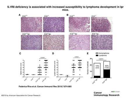 IL1R8 deficiency is associated with increased susceptibility to lymphoma development in lpr mice. IL1R8 deficiency is associated with increased susceptibility.