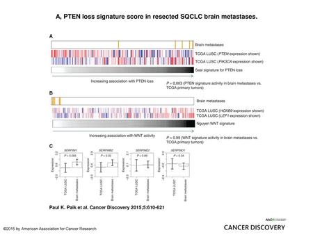 A, PTEN loss signature score in resected SQCLC brain metastases.