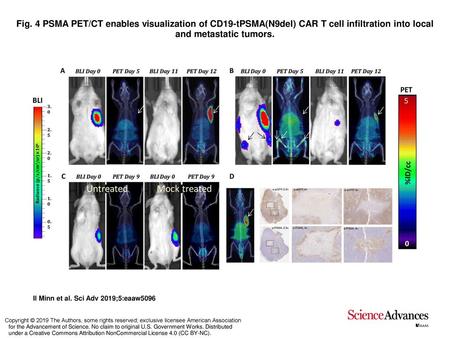 Fig. 4 PSMA PET/CT enables visualization of CD19-tPSMA(N9del) CAR T cell infiltration into local and metastatic tumors. PSMA PET/CT enables visualization.