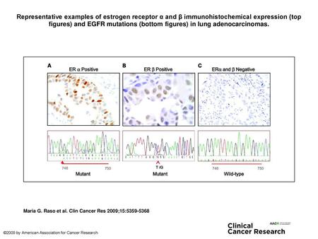 Representative examples of estrogen receptor α and β immunohistochemical expression (top figures) and EGFR mutations (bottom figures) in lung adenocarcinomas.